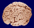 Mozog ako telesný orgán v súvislosti so zložením a vyžarovaním krvi